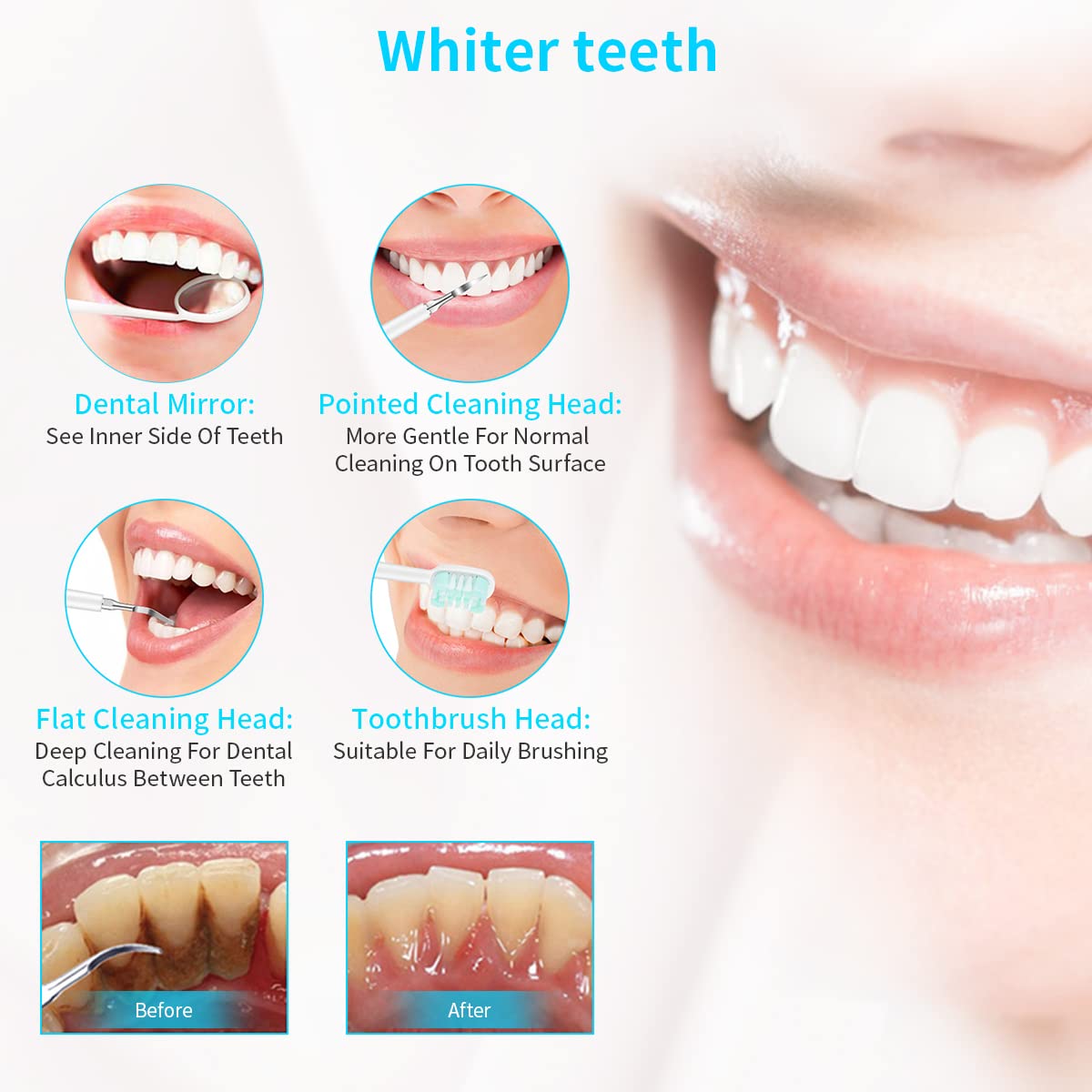 HANNEA Teeth Whitening Products Ultrasonic Tooth Care and Cleaner Kit Professional Stainless Steel Teeth Cleaning Kit Teeth Stain Remover for Teeth Improving HANNEA Teeth Whitening Products Ultrasonic Tooth Care and Cleaner Kit Professional Stainless Steel Teeth Cleaning Kit Teeth Stain Remover for Teeth Improving